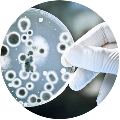 Legionellen Petrischale